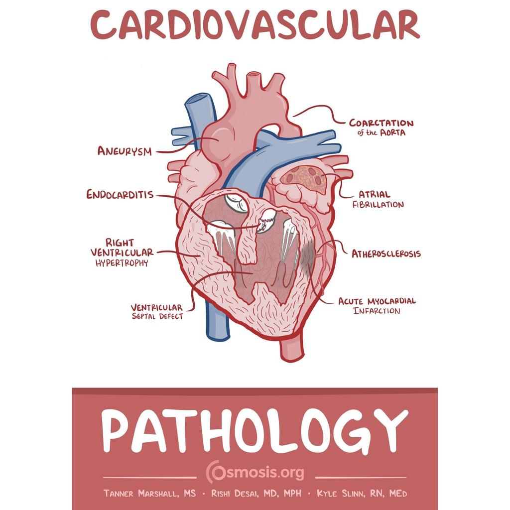 Cardiovivasular - พยาธิวิทยาโดย Tanny Marshall, Rishi Desai, Kyle Slinn