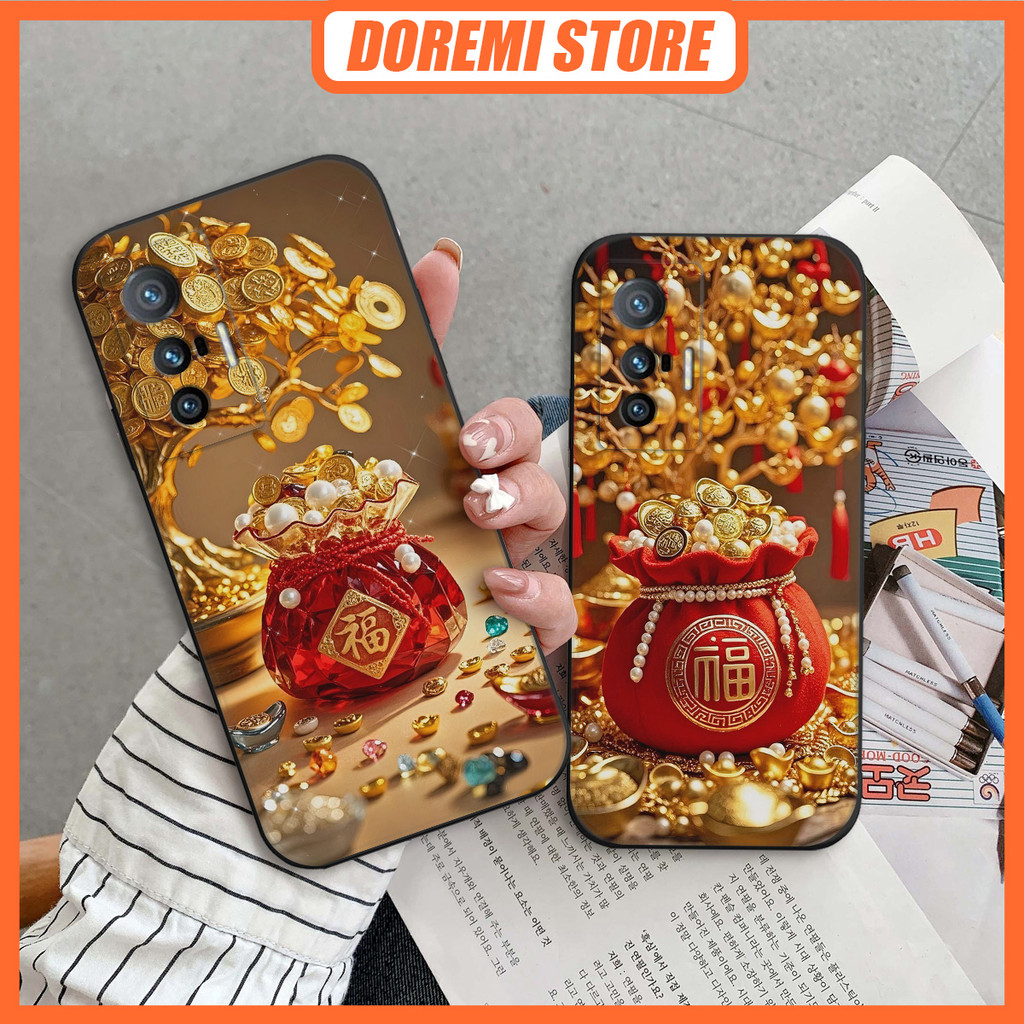 เคส Vivo X70 / X70 Pro พิมพ์ลายกระเป๋านําโชค โชคลาภ