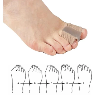 แยกนิ้วเท้า 1 แพ็ค ซิลิโคนแบนด์เจ Hallux Valgus พร้อม 2 วงสำหรับการปรับนิ้วเท้าและบรรเทาอาการปวด