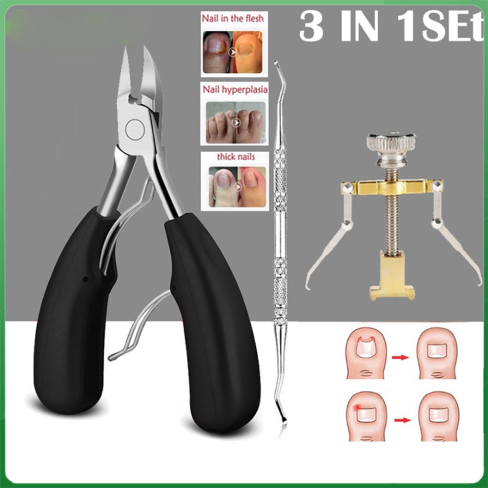 Ingrown TOENAIL ชุดเครื่องมือกรรไกรตัดเล็บ สเตนเลส 2 3 ชิ้น ต่อชุด