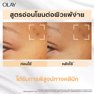 Olay Luminous Vitamin C Sensitive Brightening Moisturiser 50g.