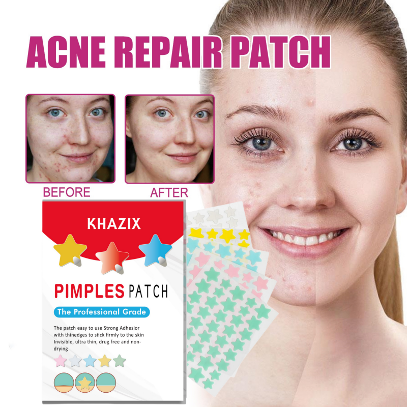 200 ชิ้น Star Acne Patch ลบสิวสิวลบสิวลบสิวที่มองไม่เห็นสิวรอยสิว Blemishes