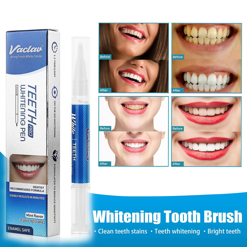 ขจัดคราบ Brightening ฟันไวท์เทนนิ่งปากกาอย่างอ่อนโยนลบสีเหลืองฟันไวท์เทนนิ่งเจลฟันปากกา