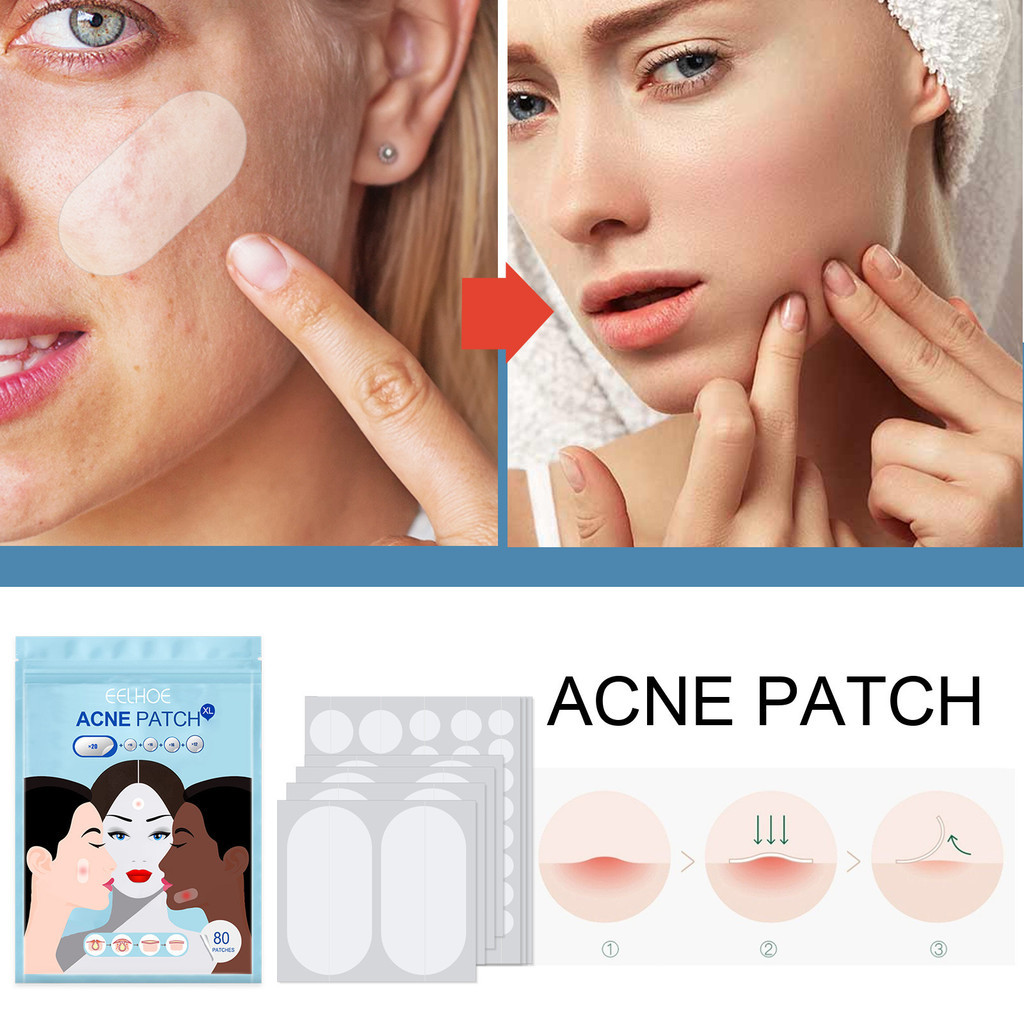 Eelhoe แผ่นแปะสิวที่มองไม่เห็น Anti-Acne Patch ปิดปากและสิวคอนซีลเลอร์กันน้ํา Hydrocolloid Acne Patch