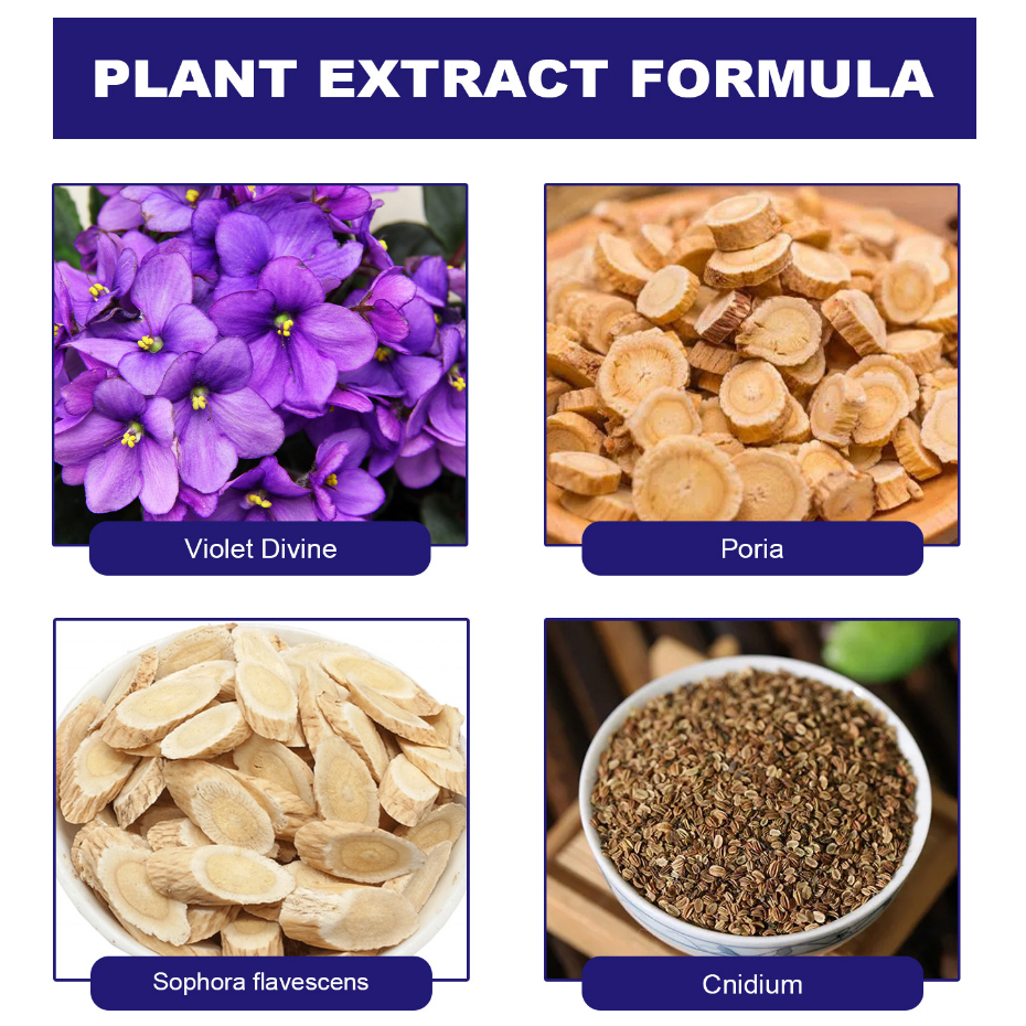 ครีมธรรมชาติสําหรับโรคสะเก็ดเงินและโรคเรื้อนกวาง ลดอาการคันผิว ขนาด 30 กรัม - รูปที่ 4