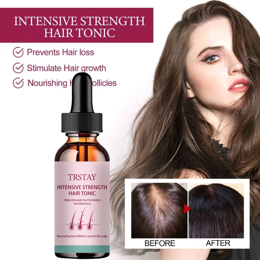 ใหม่ Hair Growth Oil Hair Growth Essence Hair Thinning Treatment ผู้ชายและผู้หญิง Hair Growth Essence Rapid Hair Growth Liquidel