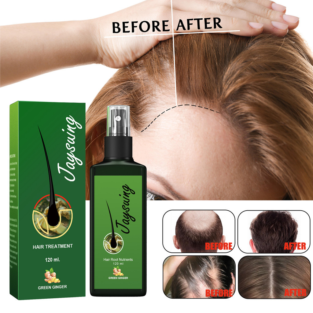 [ซัพพลายแบบออฟเดอะเลเยอร์] Jaysuing Hair Densifying Liquid Strengthening Hair Nourish Hair Root Scalp Massage Nutritive Lotion 30ml/120ml