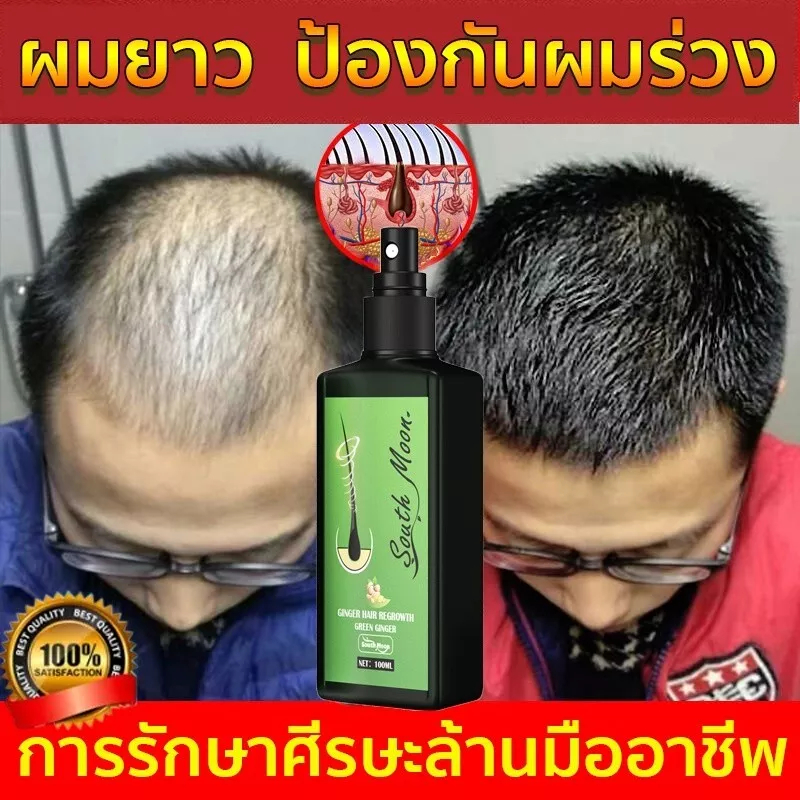เซรั่มปลูกผมขิงพร้อมน้ํามันขิง - ทรีทเม้นต์ป้องกันผมร่วงส่งเสริมผมหนาอิ่มขึ้นและเร็วยิ่งขึ้น ABBY
