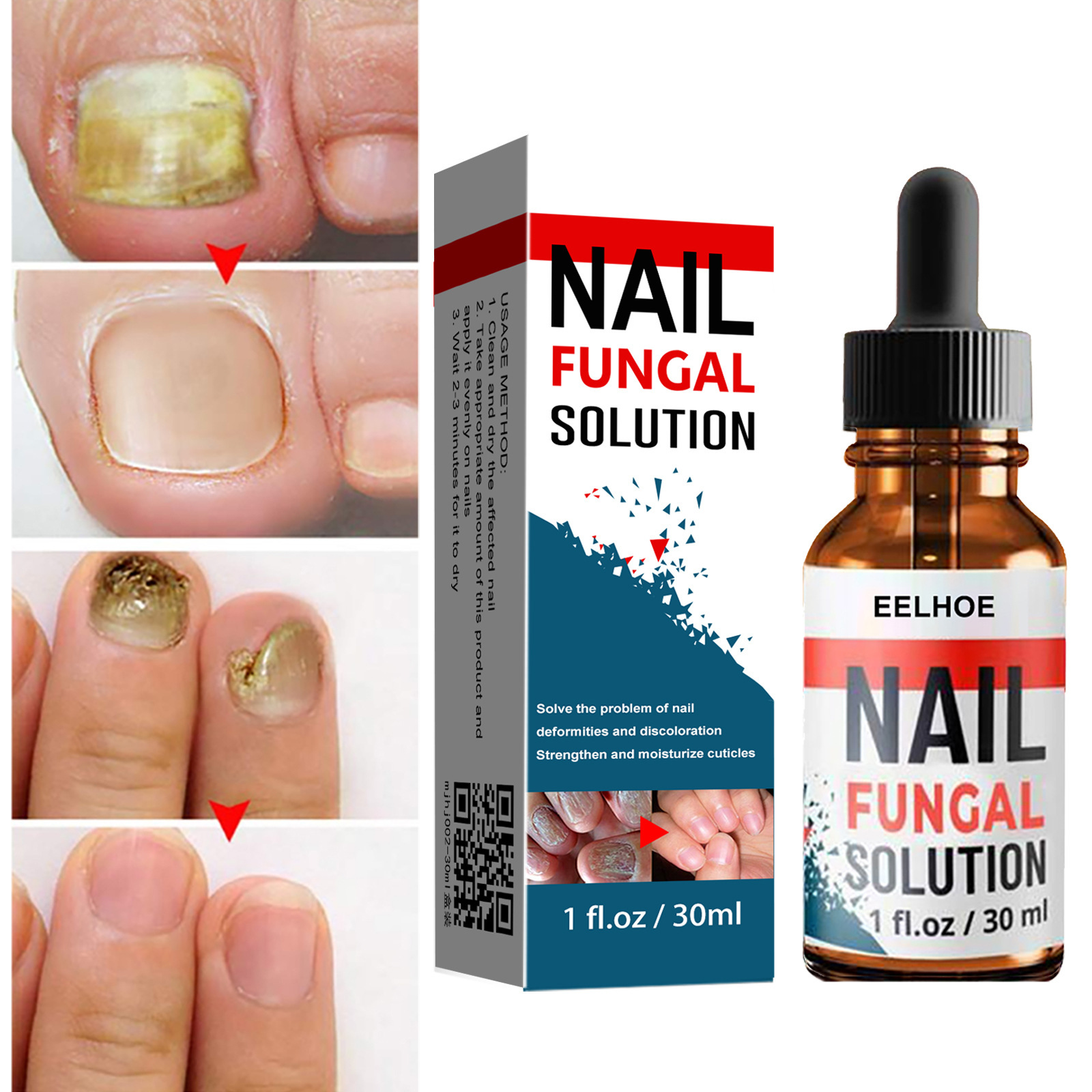 ของเหลวสําหรับมือและเท้า เล็บ 30ml Eelhoe – สําหรับเชื้อราที่เล็บและหนาอ่อน | สนับสนุนการซ่อมแซมเล็บ, บํารุงดูแล, สุขภาพดีทุกวัน