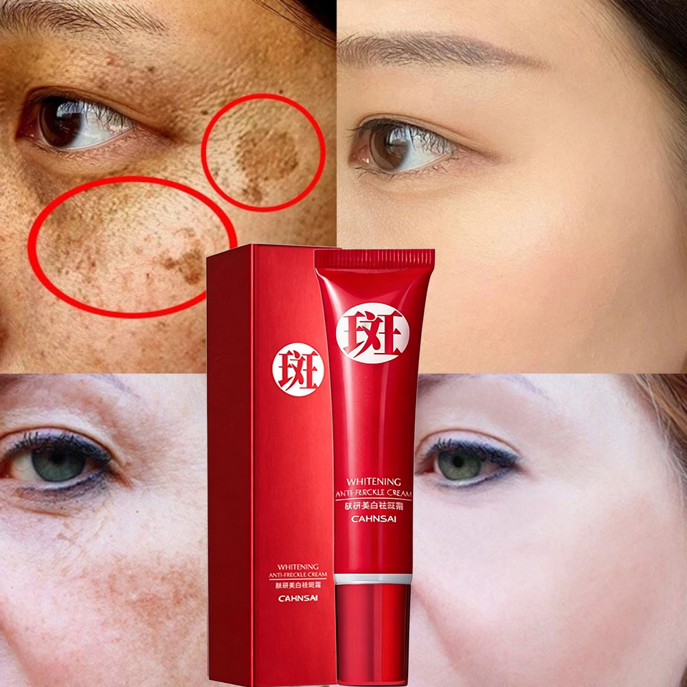 ครีมเมลาสม่า ลดฝ้า กระ จุดด่างดํา ลดเลือนรอยสิว ผิวกระจ่างใส CAHNSAI 20 กรัม