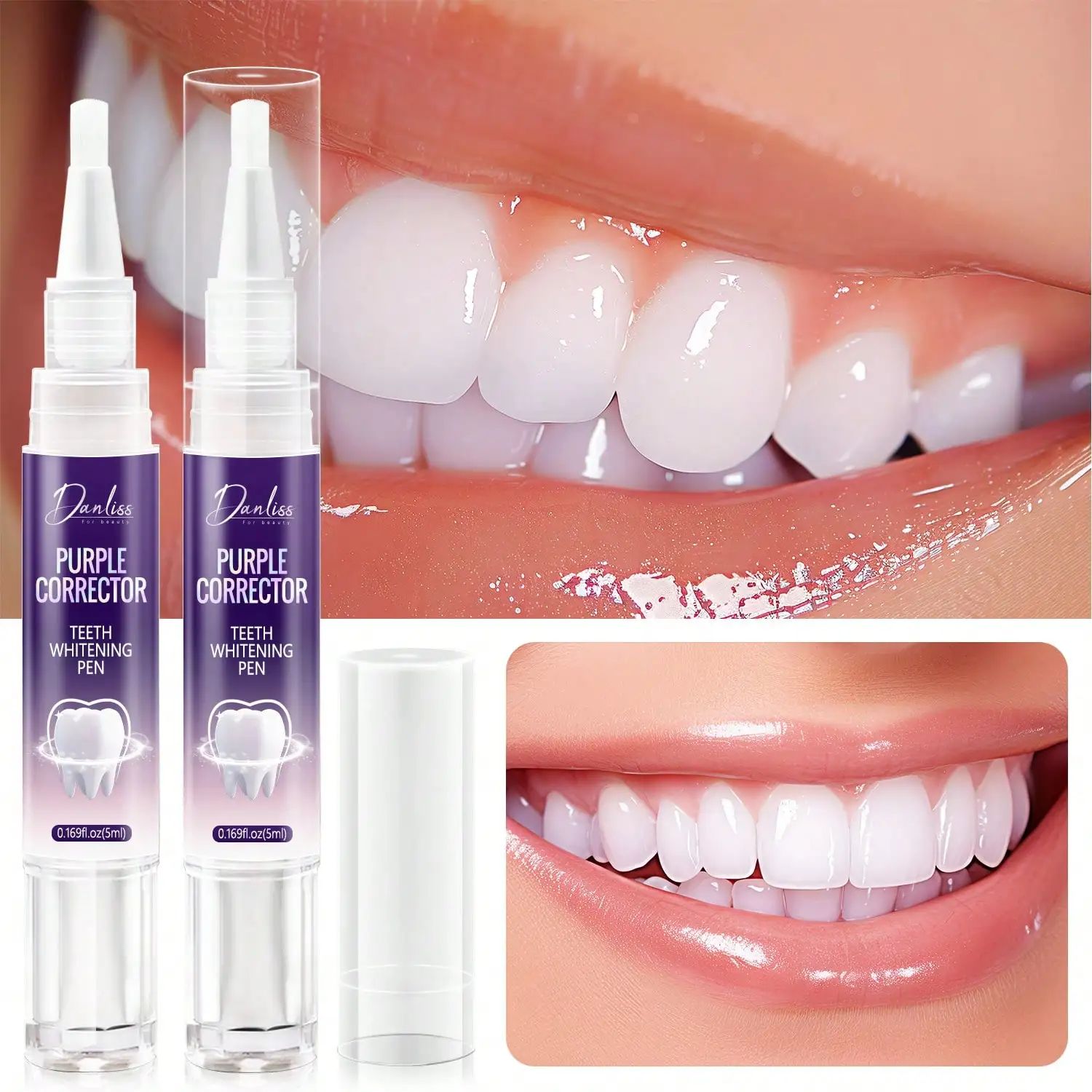 ปากกาฟอกสีฟัน-ตัวแก้ไขสีม่วง, การกําจัดคราบ, ปลอดภัยบนเคลือบฟัน, ปรับปรุงรูปลักษณ์ของฟัน, เพิ่มรอยยิ้ม