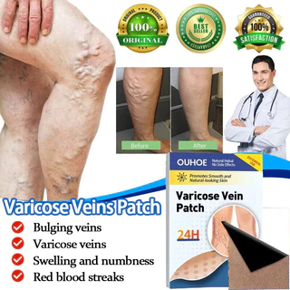 แผ่นแปะรักษาเส้นเลือดขอด Varecose Vein Remover ช่วยส่งเสริมการไหลเวียนโลหิต - 28793503672