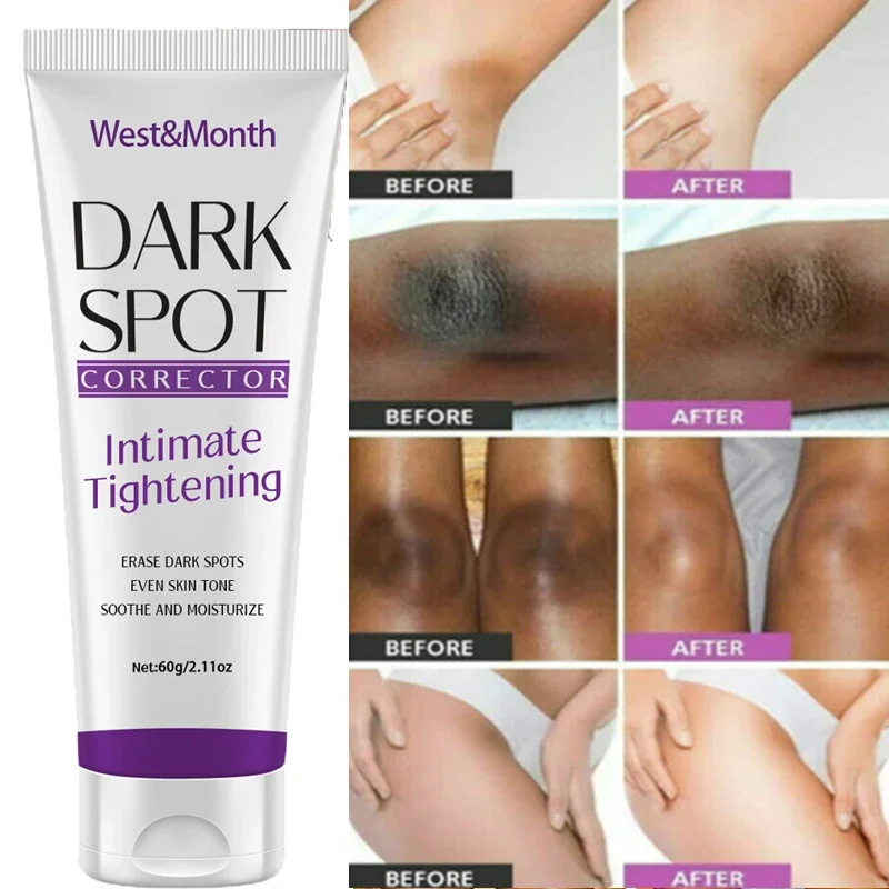 Nicotinamide Brightening Cream สําหรับผิวคล้ําที่มีประสิทธิภาพ Lighten ต้นขาด้านใน Bleach ลบเมลานิน Private Parts Brighten Cream