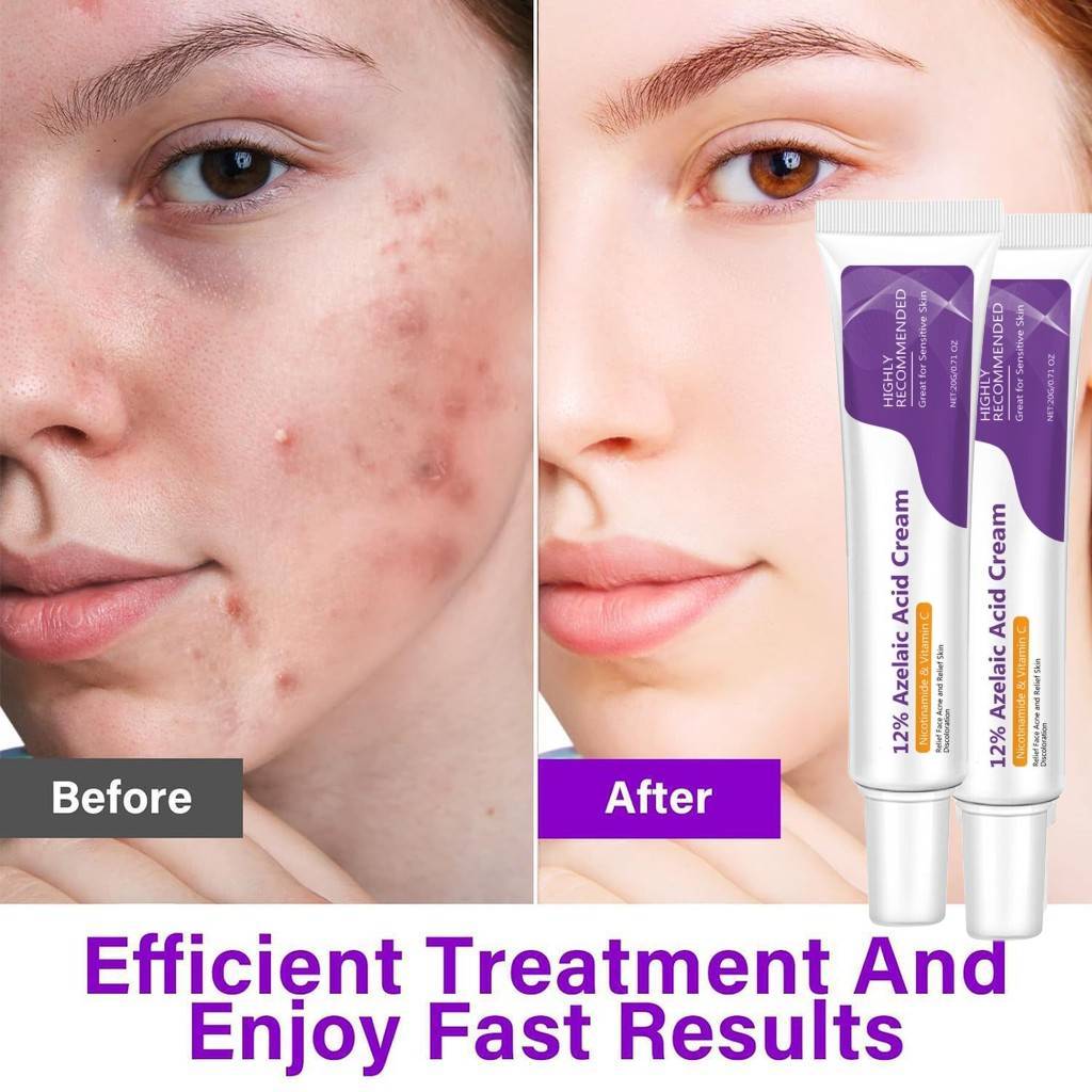 Azelaic Acid Serum: สูตรไฮยาลูโรนิก แอนด์ ไนอาซินาไมด์ ไบรท์เทนนิ่ง  สกินแคร์ ของขวัญสําหรับผู้หญิง