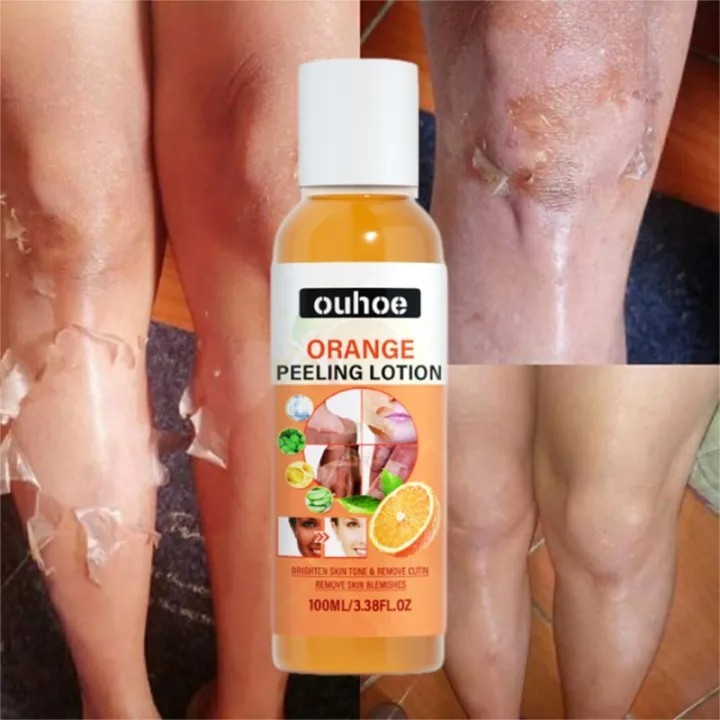 สีเหลือง Peeling Oil Bleaching Face Body Dark Skin Brighten Whiten โลชั่นมือเท้า Dead Skin Peel Exfo