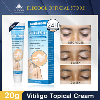 ครีมรักษาจุดด่างดําจากดวงจันทร์ใต้ 20g - ครีมรักษาเฉพาะจุดสํ…