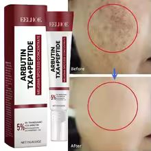 ครีมแต้มฝ้า 15g - ลดเลือนฝ้าดํา ฝ้า กระ จุดด่างดํา บํารุงผิวชุ่มชื้น ดูแลผิว升级版
