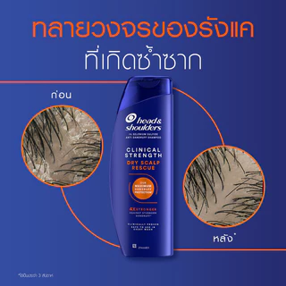 Head and Shoulders Clinical Strength Shampoo 400ml แชมพูขจัดรังแค Anti Dandruff