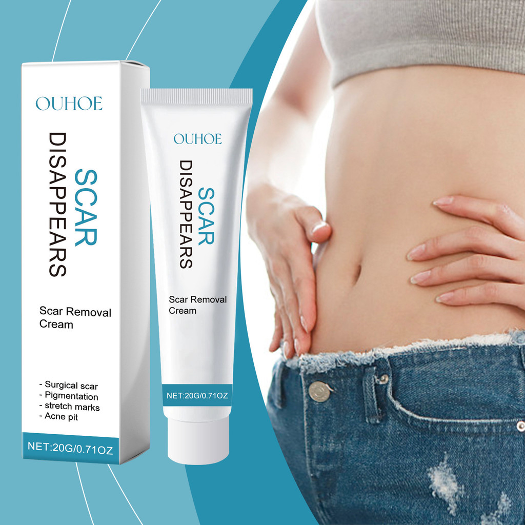  ครีมลดเลือนรอยแผลเป็นและรอยสิวขั้นสูง ผสมวิตามินอีและวิชฮาเซล ซึมซาบเร็วไม่เหนอะหนะ