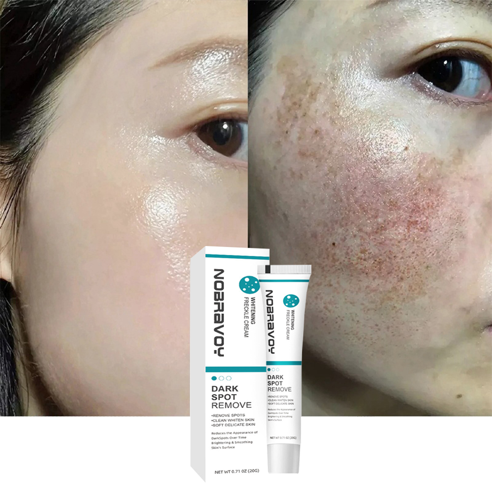 Dark Spot Cream For Face & Body Corrector ขจัดฝ้ากระ Sun Spot รอยดํา 20g