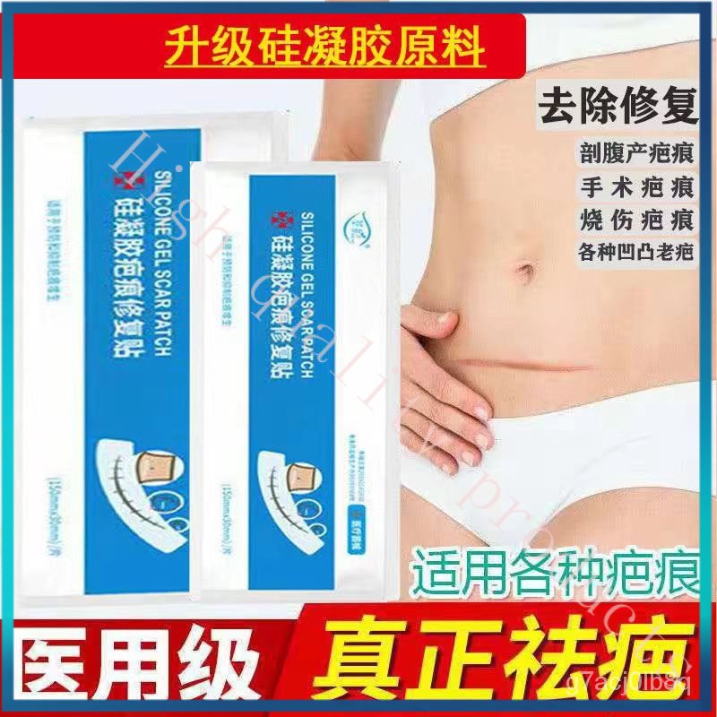 Medical Scar Patch Hyperplasia Repair โดยไม่มีร่องรอยลบรอยแผลเป็นจากการผ่าตัดและรอยแผลเป็น 0PPN
