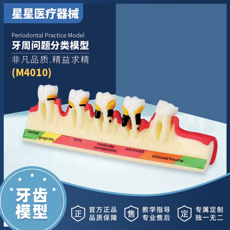 Dental Model Dental Implant Stone Dentures Dental Periodontal Disease