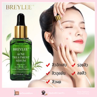 BREYLEE เซรั่มรักษาสิว เอสเซ้นส์ ลดสิว สิวในวัยรุ่น สิวอุดตัน สิวผด ไม่มีหัว อักเสบ สิวหัวขาว กระชับรูขุมขน บอกลาปัญหารูขุมขนกว้างได้อย่างง่ายด ครีมลดสิว ครีมรักษาสิว ครีมลดรอยสิว ครีมแต้มสิว เซรั่มบำรุงผิวหน้า Acne cream