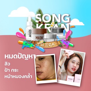 [โค้ดส่วนลด] ครีมบำรุงผิวหน้าเธอร่า ลดสิว ฝ้า กระ เพิ่มความกระจ่างใส