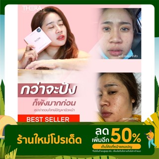 ครีมบำรุงผิวหน้า เธอร่า ลดสิว ฝ้า กระ เพิ่มความกระจ่างใส