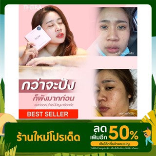 ครีมบำรุงเธอร่า ตอบโจทย์ปัญหาผิวหน้า ของแท้