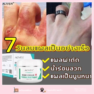 ALIVER ครีมลดรอยแผลเป็น ครีมลบรอยแผลเป็น ส่วนผสมปลอดภัยไม่มีฮอร์โมน กำจัดรอยแผลเป็นผ่าตัด น้ำร้อนลวก รอยแตกลาย สิวผื่น มีประสิทธิภาพ ลดรอยแผลเป็น ลบรอยแผลเป็นโดยไม่ทิ้งร่องรอยไว้ ซ่อมแซมผิวเสียลาย ครีมลดรอยสิว scar cream