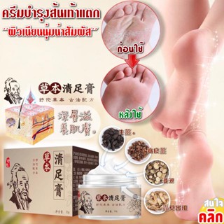 ครีมบำรุงผิวส้นเท้าแตกแห้งกร้าน -ขนาด 30g