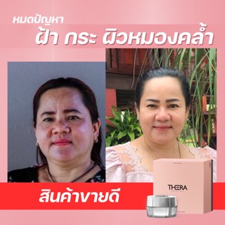 ขนาดทดลอง ครีมบำรุงผิวหน้า เธอร่า อินเทนซีฟ ไวท์เทนนิ่ง ครีม Intensive whitening cream