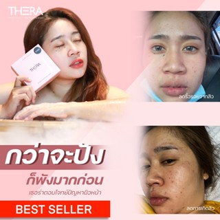 ครีมบำรุงผิวหน้า เธอร่า Intensive whitening cream