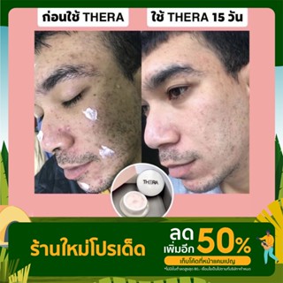 สินค้าพร้อมส่ง ครีมบำรุงผิวเธอร่า ช่วยลดสิว ฝ้า กระ ริ้วรอย และเพิ่มความสว่างใส