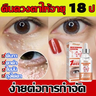 ครีมทารอบดวงตา30ml ตีนกา รอยคล้ำใต้ตา ถุงใต้ตา ขจัดอนุภาคไขมัน เซรั่มถุงใต้ตา ครีมทาตาเม็ดไขมัน ครีมทารอบดวงตา อายครีม