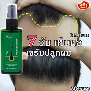 【สินค้านำเข้า】น้ำยาปลูกผม สเปรย์ปลูกผม (แชมพูขิงบริสุทธิ์, ผมร่วง, ยาแก้ผมร่วง, แชมพูขิง, แชมพูแก้ผมร่วง, เอสเซ้นส์ผมร่ว