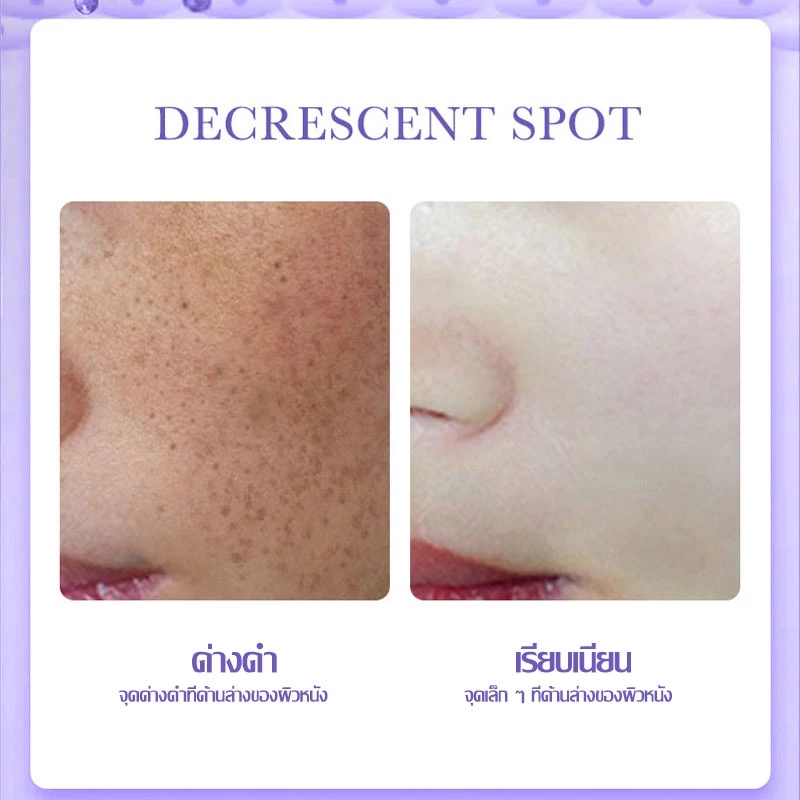 SADOER เซรั่มลดฝ้ากระ ลดสิว หน้าขาว 30ml thumbnail 7