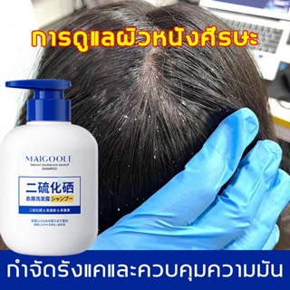 【สินค้าขายดี】300ml ยาสระผมขจัดรังแค แชมพูขจัดรังแค ซีลีเนียมไดซัลไฟด์（แชมพูรักษารังแค ทรีทเมนบำรุงผม ยารักษารังแค ดูแลหน