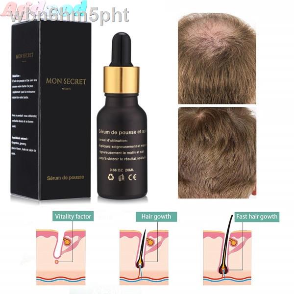 Agdoad Hair Growth Essence For Hair Loss Treatment Tonic Fast Recover Grow Longer Hair Ginger Serum Ginseng Organic Esse