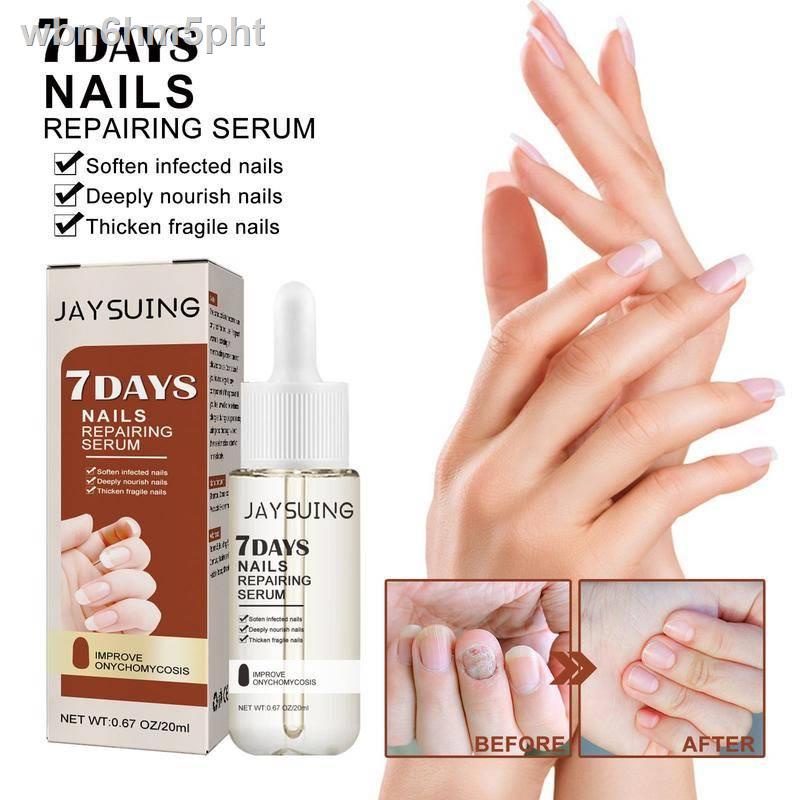 Jaysuing Fungal Nail Treatment Essence Anti Infection Onychomycosis Foot Toe Nail Fungal Removal Gel Repair Feet Care Es