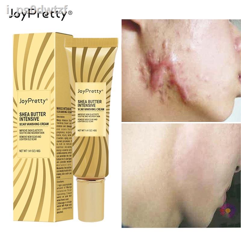 JoyPretty Acne Scar Removal Face Cream Pigmentation Corrector Whitening Smoothing Face Gel Moisturizing Cosmetics Skin C