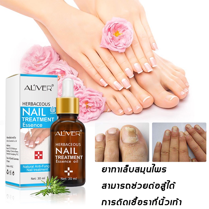 ALIVER เซรั่มบำรุงเล็บ เซรั่มเล็บ เล็บขบ เชื้อรา 30ml บำรุงเล็บ เชื้อราเล็บมือ ลากับเล็บเสีย ห่างกับปัญหาเล็บ ซ่อมแซมเล็บ ราคา ถูกที่สุด ดีลบีเคเค แกลเลอรีภาพที่ 3