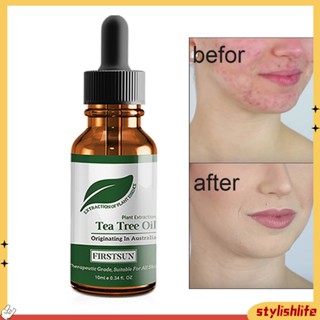 {stylishlife} Acne Treatment Skin Oil-control Pores Hydrating Tea Tree Essential Oil