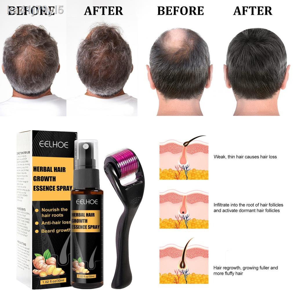 EELHOE Herbal Hair Growth Essence Spray Hair Regrowth Serum Advanced Hair Growth Treatment Serum Prevent Hair Dry Frizzy