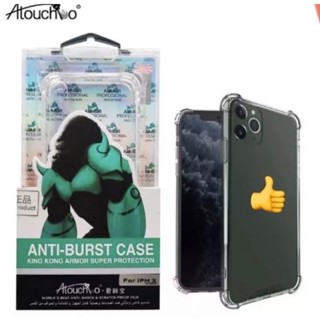 🇹🇭(ส่งจากไทย)เคส Kingkong เคสใสกันกระแทก คิงคอง ViVO Y35 / ViVO Y36 /เคสใส กันกระแทก