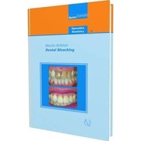 Dental Bleaching [Hardcover] Author:Martin Kelleher (1/2008) ISBN:9781850971313