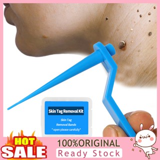 [B_398] 10Pcs/20Pcs/30Pcs/50Pcs Skin Tag Remover Micro Upgrade Handle Wart Cleansing Tool Kit for Body