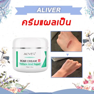 【การส่งมอบกรุงเทพฯ】 ครีมกำจัดรอยแผลเป็น 50ml ครีมลบรอยแผลเป็น ครีมลดรอยสิว แผลไฟไหม้/น้ำร้อนลวก ครีมลดแผลเป็น ลบรอยแผลเปน ครีมลบแผลเป็น