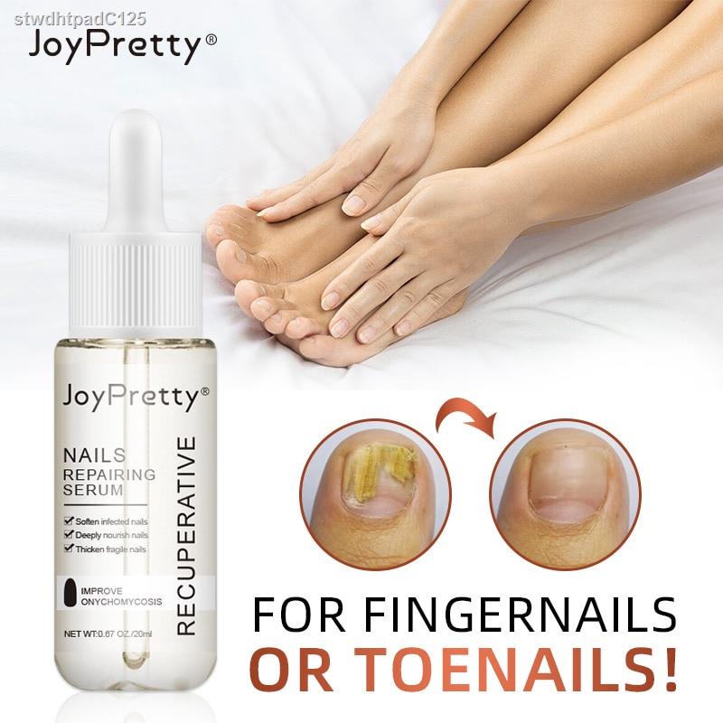 JoyPretty Fungal Nail Treatment Serum Foot Repair Essence Care Whitening Toe Nail Fungus Removal Gel Anti Infection 20ml